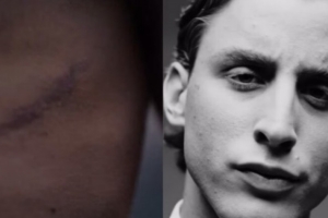 世界杯分组-罗体：博维拍摄香水广告，首次展示了自己接受心脏手术后的伤疤